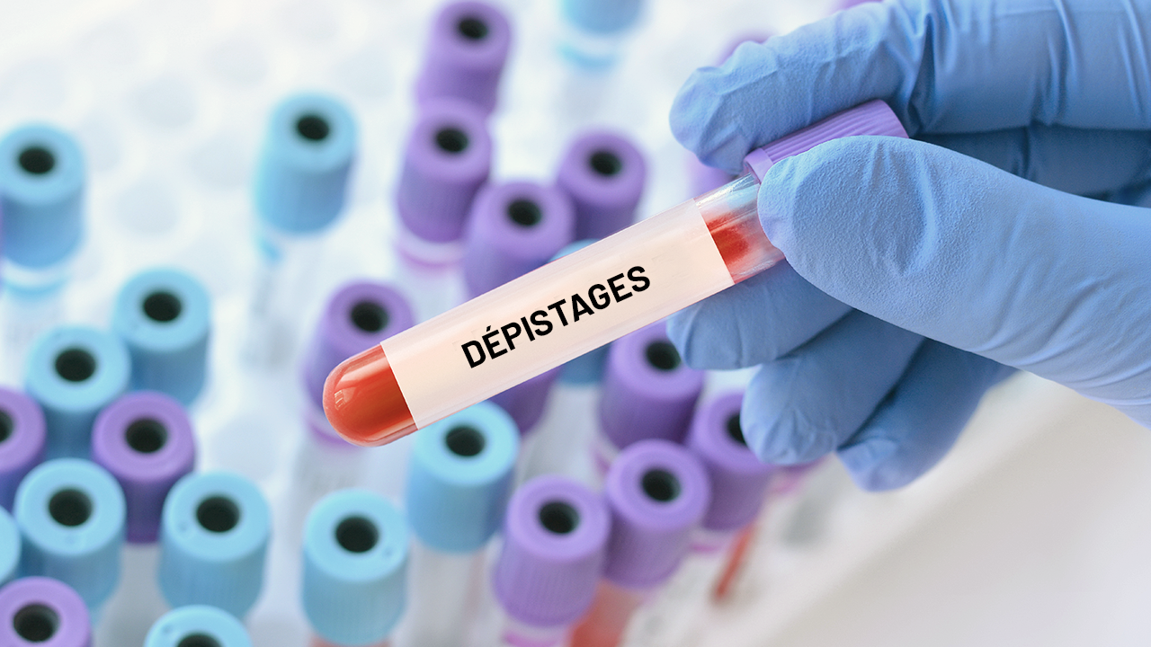 Dépistage du VIH et des IST